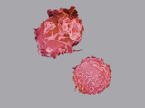 Blood Cell Apoptosis or Cell Death, SEM X3000 Photographic Print by Gopal Murti