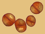 Staphylococcus Warneri Bacteria, a Pathogen for Several Human Conditions, TEM X30,000 Photographic Print by George Musil