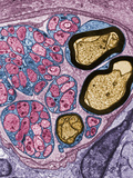 Cross-Section of a Nerve Fiber in Intestinal Connective Tissue Showing Photographic Print by David Phillips