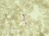 Trypanosoma Brucei Protozoans in Blood, the Pathogen of African Sleeping Sickness, LM X400 Photographic Print by Frederick Skarva