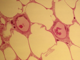 Fat or Adipose Cells, LM X150 Photographic Print by David Phillips
