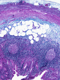 Cross Section of the Appendix, LM X13 Photographic Print by Frederick Skarva