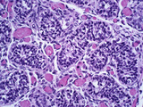 Cross-Section of Immature Human Testis Seminiferous Tubules, LM X78 Photographic Print by Frederick Skarva