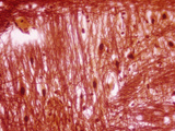 Pons Section of the Human Brain, Silver Stain, LM X100 Photographic Print by Arthur Siegelman