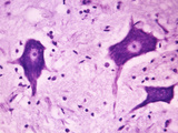 Human Brain Cortex Neurons and Nissl Bodies, LM X100 Photographic Print by Arthur Siegelman