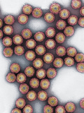 Reovirus, So-Named for Respiratory Enteric Orphan Virus Photographic Print by Gopal Murti