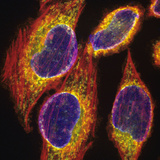 Fluorescent Confocal Image of Hela Cells Photographic Print by Gopal Murti