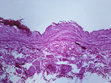 Cross-Section of the Wall of the Normal Vena Cava, H&E Stain, LM X31 Photographic Print by Frederick Skarva