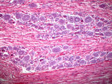Spinal Cord Ganglion Tissue, LM Photographic Print by David Phillips