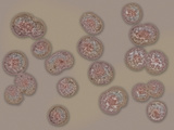 (Branhamella Catarrhalis)Bacteria Bound to the Surface of a Human Red Blood Cell, TEM X39,000 Photographic Print by George Musil