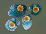 The Varicella-Zoster Viruses Is from the Herpes Family and Causes Chickenpox and Shingles Photographic Print by George Musil