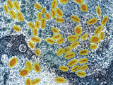 Human Pox Virus Pox Viruses are the Largest and Most Complex of All the Viruses Photographic Print by George Musil