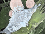 Macrophage (Blue) Consuming Leukemic Cells (Pink), SEM X2000 On A 3"X4" Image Photographic Print by Gopal Murti