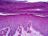 Cross-Section of Normal Skin from the Sole of the Foot, H&E Stain, LM X78 Photographic Print by Frederick Skarva