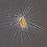 Golden-Brown Algae (Mallomonas Tonsurata), a Freshwater Chrysophyte, LM Photographic Print by Peter Siver