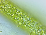 Tribophyte Vaucheria, a Long Tubular Coenocytic Tribophyte, Xanthophyte Photographic Print by Peter Siver