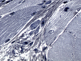 Non-Keratinized Stratified Squamous Epithelium of the Tongue, Iron Hematoxylin Stain, LM X200 Photographic Print by Alvin Telser