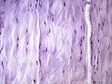 Tendon Section, H&E Stain, LM X200 Photographic Print by Alvin Telser