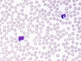 Normal Human Blood with a Monocyte (Lower Left) and a Segmented Neutrophil (Upper Right) Photographic Print by Gladden Willis