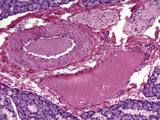 Submandibular Salivary Gland Section, H&E Stain, LM X125 Photographic Print by Alvin Telser