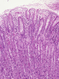 Human Stomach Fundus Section Showing Gastric Pits Above and Gastric Glands Photographic Print by Gladden Willis