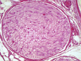 Myelinated Peripheral Nerve Section, H&E Stain, LM X180 Photographic Print by Alvin Telser