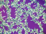 Vitamin a Crystals, Polarized, LM Photographic Print by Arthur Siegelman