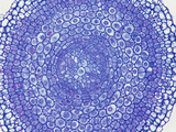Cross-Section of a Buttercup Root (Ranunculus), a Dicot, LM X35 Photographic Print by  Biodisc