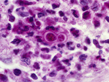 Budding Yeast of Blastomyces Dermatitidis Fungus Photographic Print by Gladden Willis