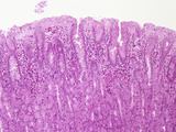 Human Stomach Fundus Section the Gastric Pits are Above and the Gastric Glands Photographic Print by Gladden Willis
