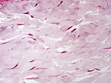 Dense Irregular Connective Tissue from the Intestine Submucosa, H&E Stain, LM X480 Photographic Print by Alvin Telser