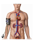 Illustration Showing the Placement of a Sphygmomanometer or Blood Pressure Cuff on the Right Arm Reproduction procédé giclée par  Nucleus Medical Art