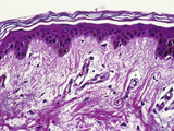 Human Abdomen Skin Section Showing Melanin Pigmentation, LM X200 Photographic Print by Gladden Willis