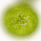 Eremosphaera, a Large Single Celled Green Algae Containing Many Small Chloroplasts Photographic Print by Peter Siver