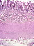 Human Duodenum Region of the Small Intestine Mucosal Crypts Lined by Simple Columnar Epithelium, Photographic Print by Gladden Willis