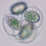 Glaucocystis, Colonial Glaucophyte with Cells Containing Star-Shaped Blue Green Plastids Photographic Print by Peter Siver