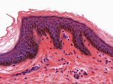 Skin Dermis Section, Milligan Trichrome Stain, LM X160 Photographic Print by Alvin Telser