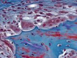 Osteoclasts at the Tips of the Bone Spicules of Newly Formed Bone, Trichome Stain, LM X400 Photographic Print by Alvin Telser