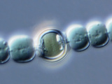 Anabaena Cyanobacterium with a Heterocyst, LM Photographic Print by Peter Siver