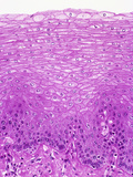 Human Esophagus Section Showing the Stratified Squamous Epithelial Muscosal Lining, LM X128 Photographic Print by Gladden Willis