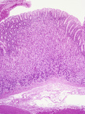 Human Gastric Stomach Mucosa with Smooth Muscle Wall Below, H&E Stain, LM X10 Photographic Print by Gladden Willis