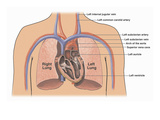 Illustration of the Anatomy of the Heart and Great Vessels Alongside the Location of a Pacemaker Giclee Print by  Nucleus Medical Art