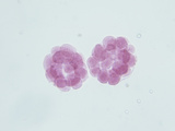 Sea Urchin Embryos, Late Cleavage Stage, Arbacia,, LM X80 Photographic Print by  Biodisc
