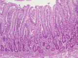 Jejunum of the Human Small Intestine with Villi and Crypts Lined by the Simple Columnar Epithelium Photographic Print by Gladden Willis