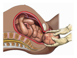 Illustration of a Mid-Line Cut-Away View of a Normal Vaginal Delivery Giclee Print by  Nucleus Medical Art