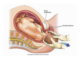 Illustration of a Mid-Line Cut-Away View of a Normal Vaginal Delivery Giclee Print by  Nucleus Medical Art