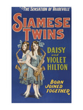 Siamese Twins Print