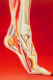 Posterior Calcaneal Spur