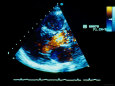 Historical Ultrasound of Heart Ultrasound Photographie