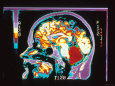 Digitized MRI Brain, Lateral View Lámina fotográfica